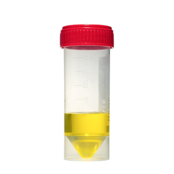 30ml beaker with red screwcap, polypropylene, graduated, with frosted writing zone