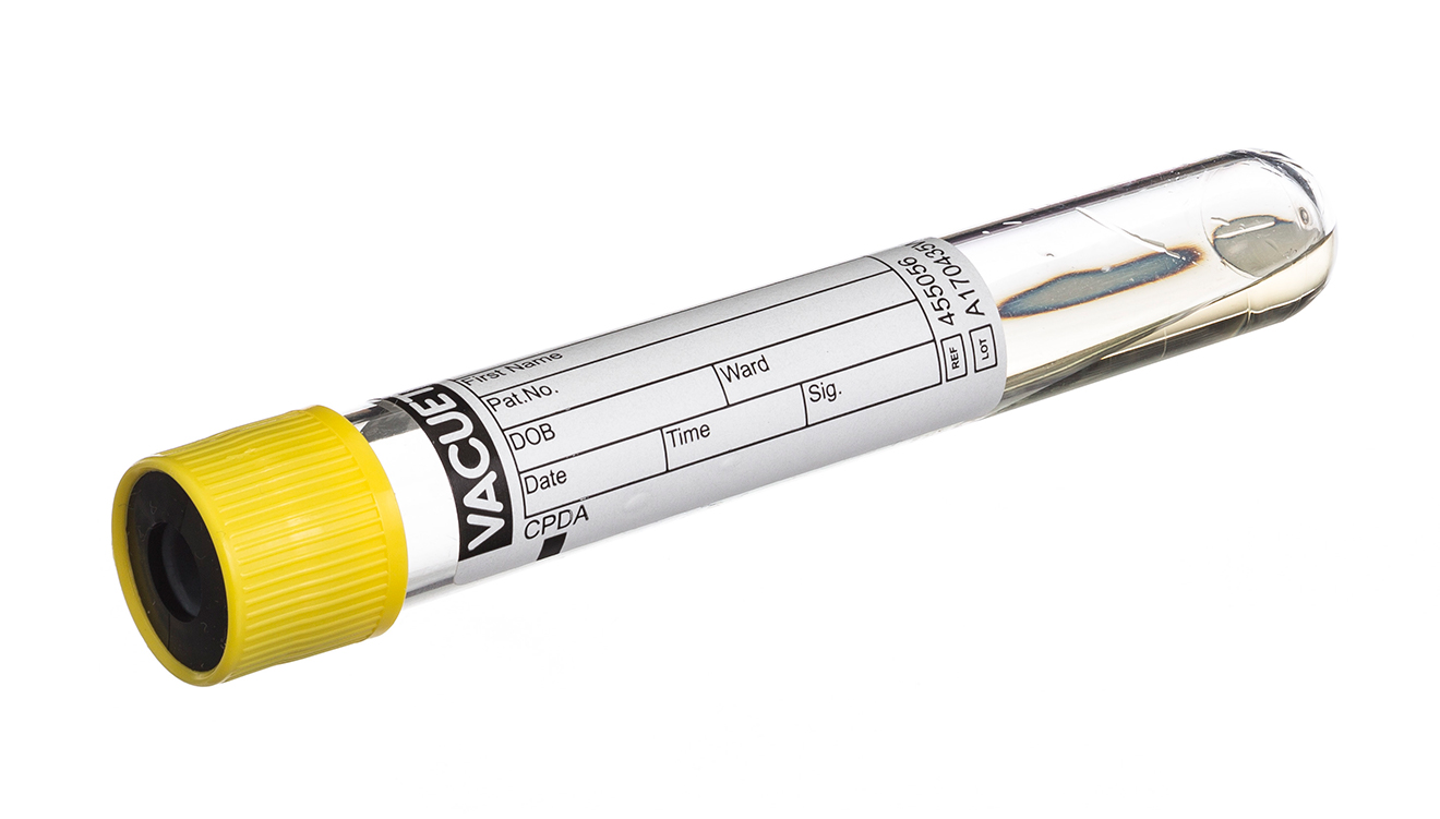 Vacuette tube 9ml, 100x16mm, bouchon à pression jaune avec anneau noir, CPDA, Greiner