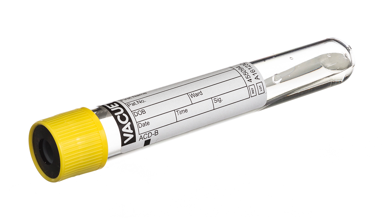 Vacuette tube 9ml, 100x16mm, bouchon à pression jaune avec anneau noir, ACD-B, Greiner