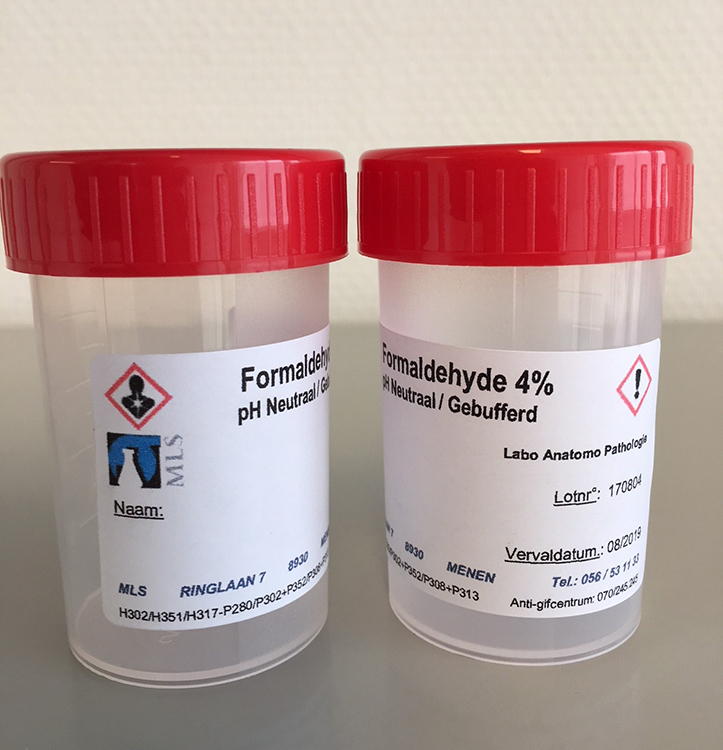 60ml beaker plp with red scewcap +30ml neutral formaldehyde 4% buffered+ personalised MLS label