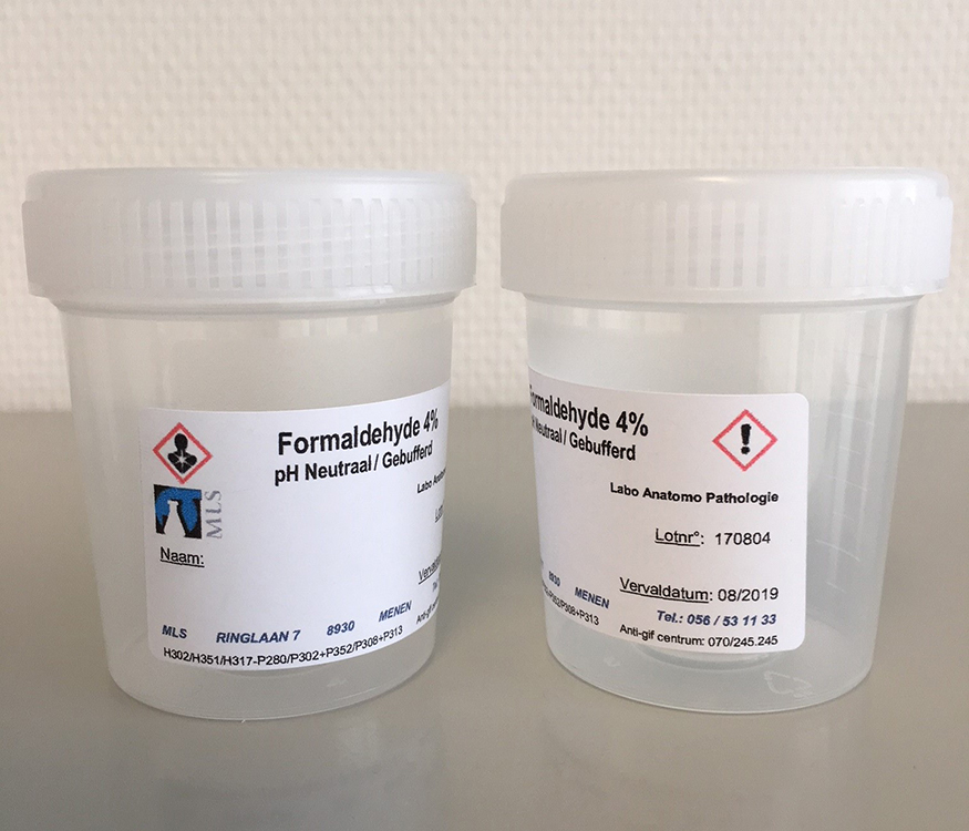 125ml beaker plp with natural scewcap, 60ml neutral formaldehyde, 4% buffered, personalised MLS label