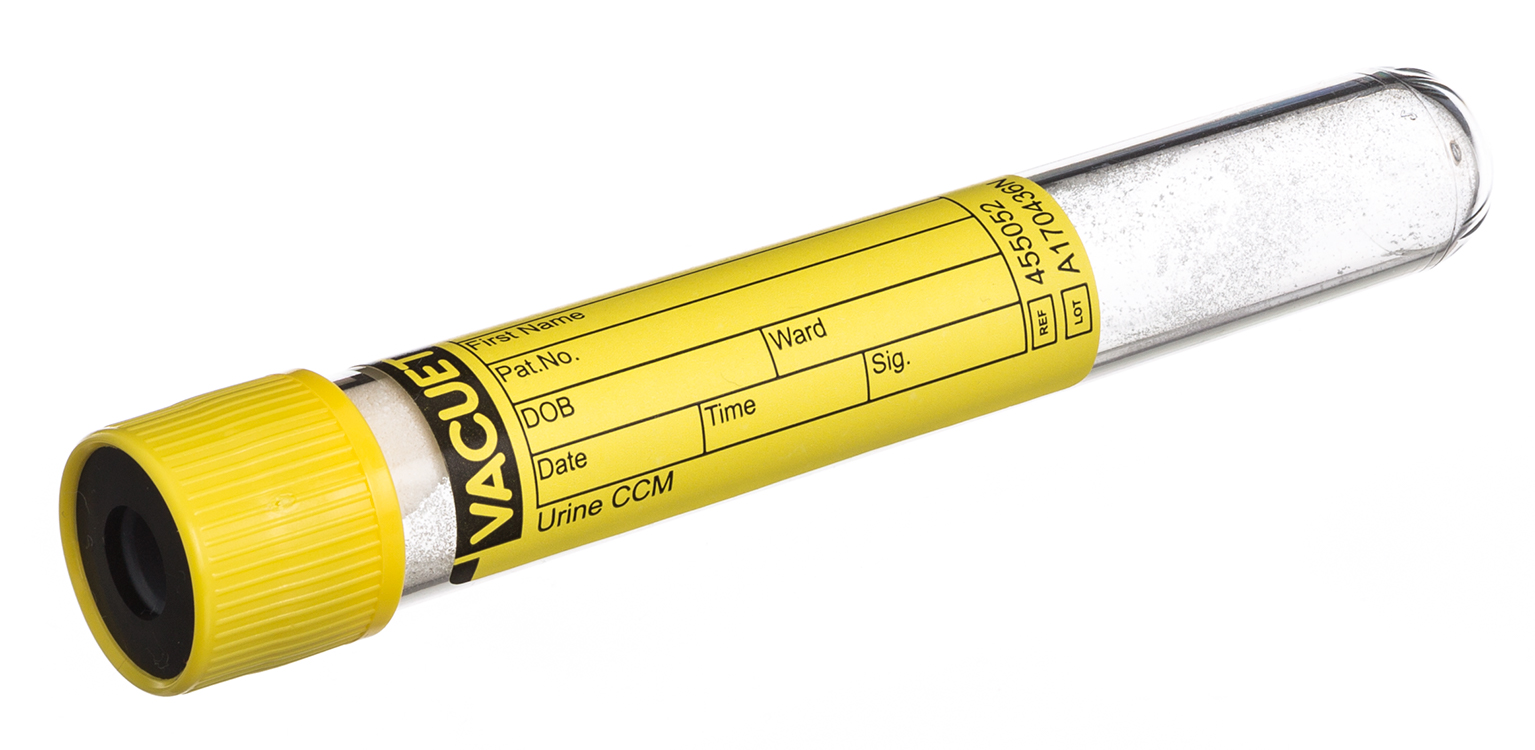 Vacuette tube urine 10ml, 100x16mm, bouchon à pression jaune avec anneau noir, CCM, fond rond, Greiner