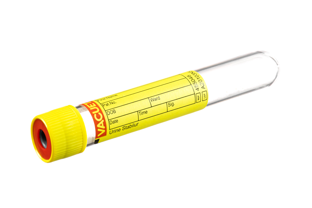 Vacuette urine tube 10ml, 100x16mm, yellow pressure cap, stabilur + round base, Greiner